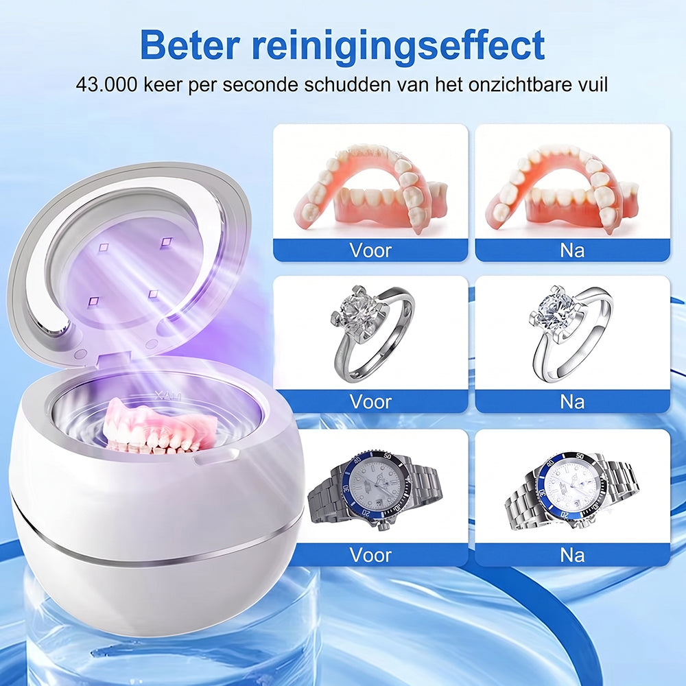 Denturexi V2